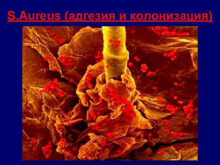 S. Aureus (адгезия и колонизация) 