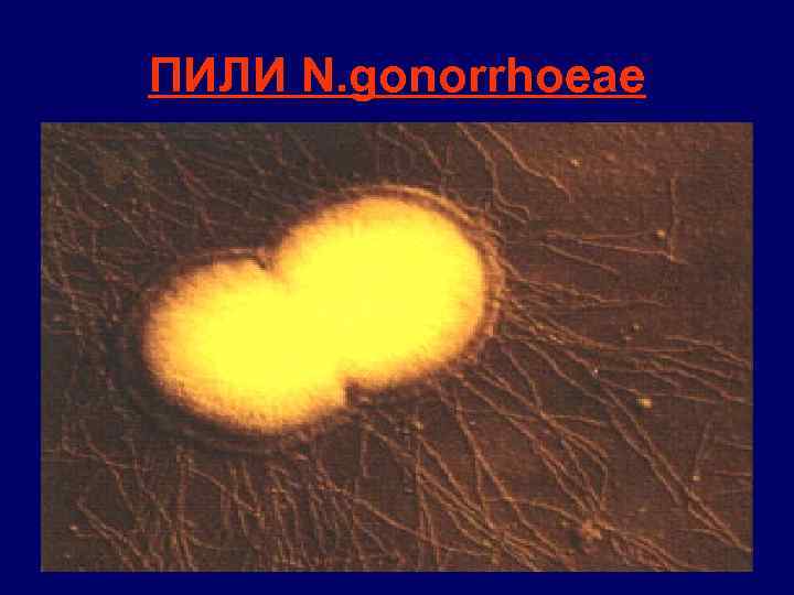 ПИЛИ N. gonorrhoeae 