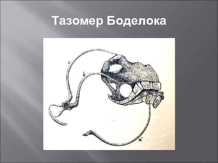 Тазомер Боделока 