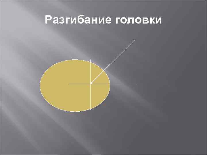 Разгибание головки 