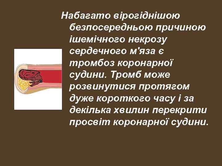 Набагато вірогіднішою безпосередньою причиною ішемічного некрозу сердечного м'яза є тромбоз коронарної судини. Тромб може