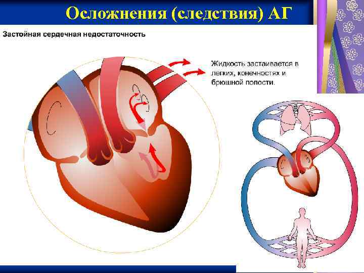 Осложнения (следствия) АГ 1/31/2018 фармакология 11 
