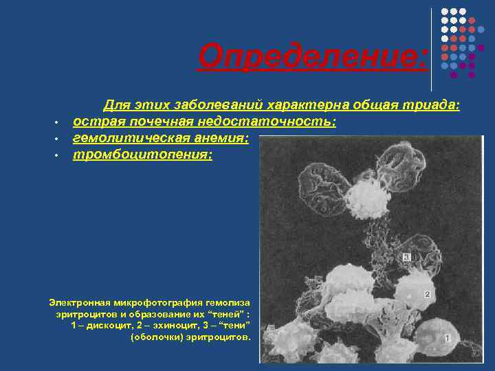 Определение: • • • Для этих заболеваний характерна общая триада: острая почечная недостаточность; гемолитическая