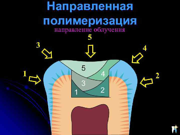 Направленная полимеризация направление облучения 3 1 5 4 2 