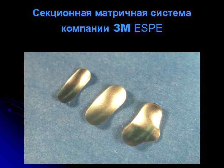 Cекционная матричная система компании 3 М ESPE 