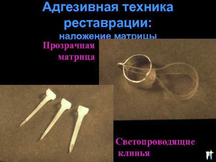 Адгезивная техника реставрации: наложение матрицы Прозрачная матрица Светопроводящие клинья 