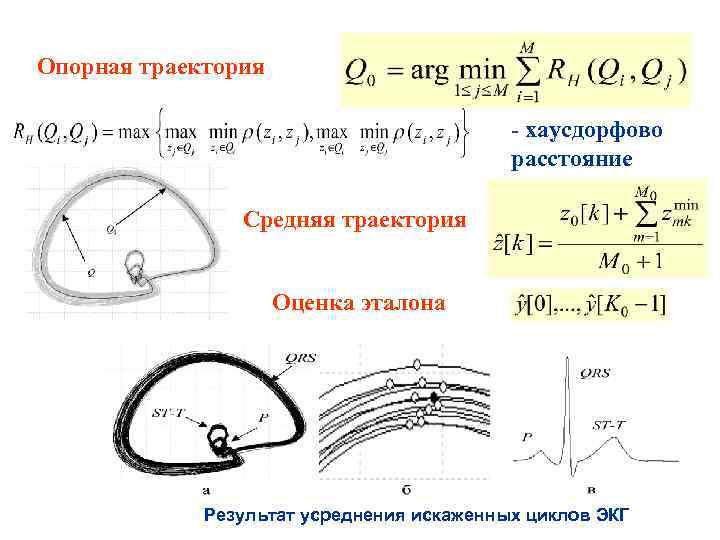 Опорная траектория - хаусдорфово расстояние Средняя траектория Оценка эталона Результат усреднения искаженных циклов ЭКГ