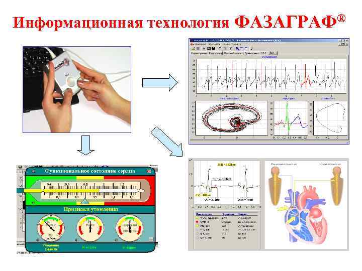 Информационная технология ФАЗАГРАФ® 