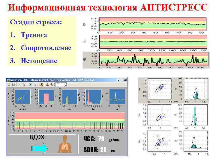 Информационная технология АНТИСТРЕСС Стадии стресса: 1. Тревога 2. Сопротивление 3. Истощение 