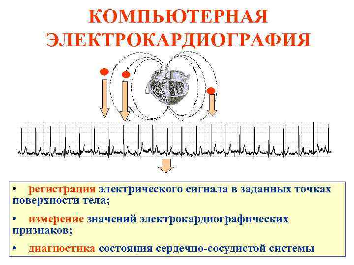 КОМПЬЮТЕРНАЯ ЭЛЕКТРОКАРДИОГРАФИЯ • регистрация электрического сигнала в заданных точках поверхности тела; • измерение значений