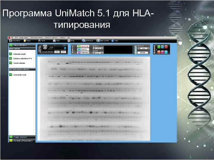 Программа Uni. Match 5. 1 для HLAтипирования 