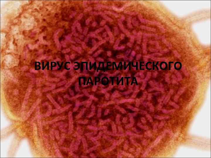 ВИРУС ЭПИДЕМИЧЕСКОГО ПАРОТИТА 