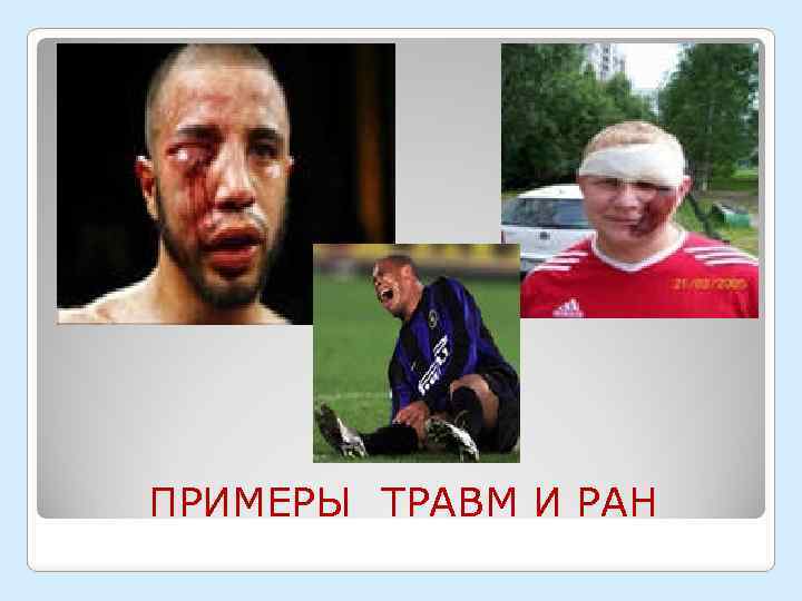 ПРИМЕРЫ ТРАВМ И РАН 