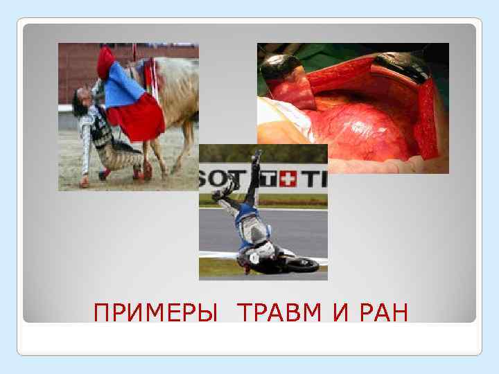 ПРИМЕРЫ ТРАВМ И РАН 