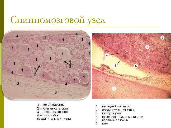 Спинномозговой узел 1 – тела нейронов 2 – клетки-сателлиты 3 – нервные волокна 4