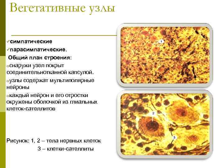 Вегетативные узлы üсимпатические üпарасимпатические. Общий план строения: oснаружи узел покрыт соединительнотканной капсулой. oузлы содержат