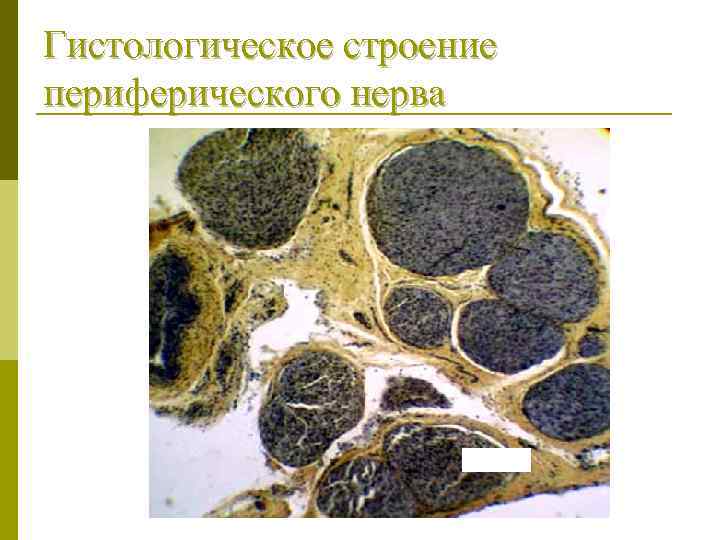 Гистологическое строение периферического нерва 