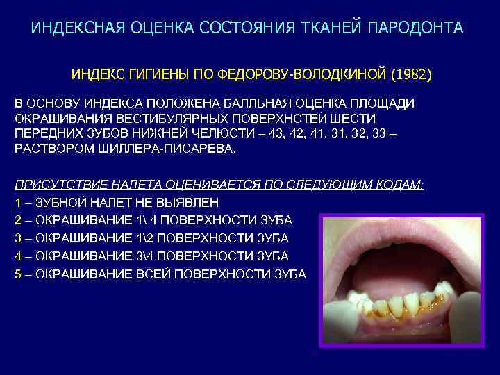 ИНДЕКСНАЯ ОЦЕНКА СОСТОЯНИЯ ТКАНЕЙ ПАРОДОНТА ИНДЕКС ГИГИЕНЫ ПО ФЕДОРОВУ-ВОЛОДКИНОЙ (1982) В ОСНОВУ ИНДЕКСА ПОЛОЖЕНА