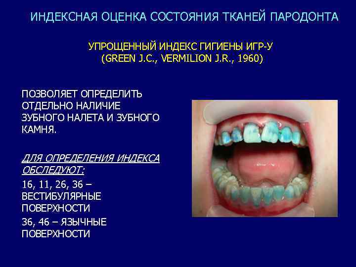 Оценка состояния полости рта