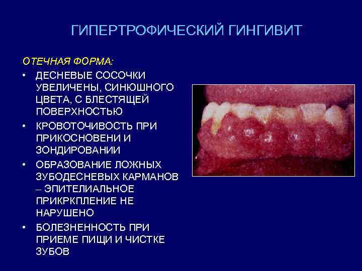 Отечный синдром фото