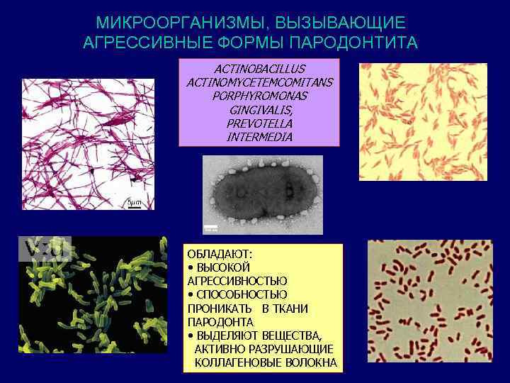 МИКРООРГАНИЗМЫ, ВЫЗЫВАЮЩИЕ АГРЕССИВНЫЕ ФОРМЫ ПАРОДОНТИТА ACTINOBACILLUS ACTINOMYCETEMCOMITANS PORPHYROMONAS GINGIVALIS, PREVOTELLA INTERMEDIA ОБЛАДАЮТ: • ВЫСОКОЙ