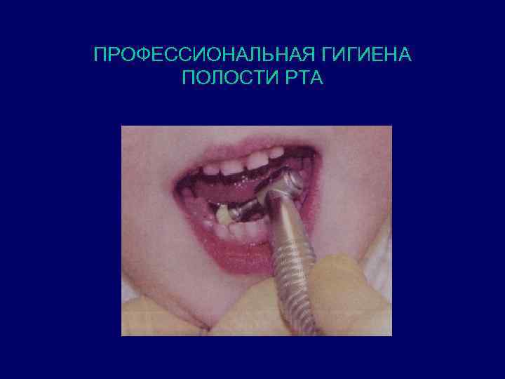 ПРОФЕССИОНАЛЬНАЯ ГИГИЕНА ПОЛОСТИ РТА 