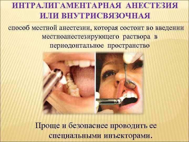 ИНТРАЛИГАМЕНТАРНАЯ АНЕСТЕЗИЯ ИЛИ ВНУТРИСВЯЗОЧНАЯ способ местной анестезии, которая состоит во введении местноанестезирующего раствора в