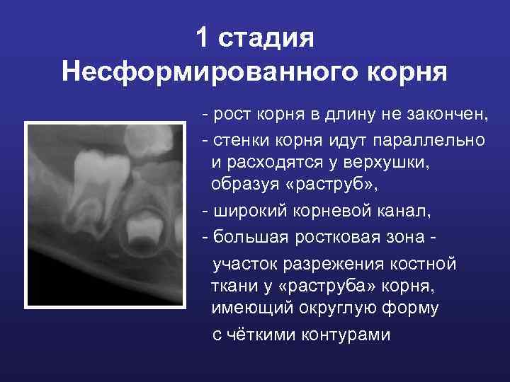 1 стадия Несформированного корня - рост корня в длину не закончен, - стенки корня