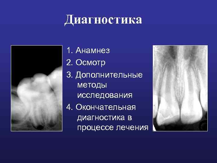 Диагностика 1. Анамнез 2. Осмотр 3. Дополнительные методы исследования 4. Окончательная диагностика в процессе
