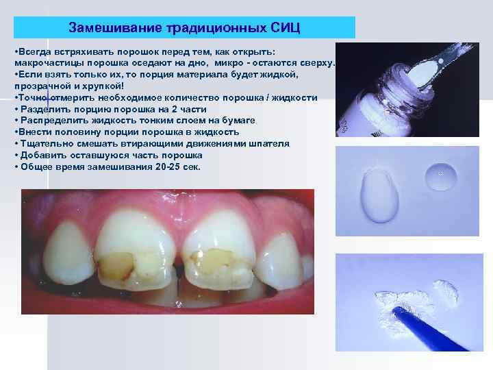 Замешивание традиционных СИЦ • Всегда встряхивать порошок перед тем, как открыть: макрочастицы порошка оседают