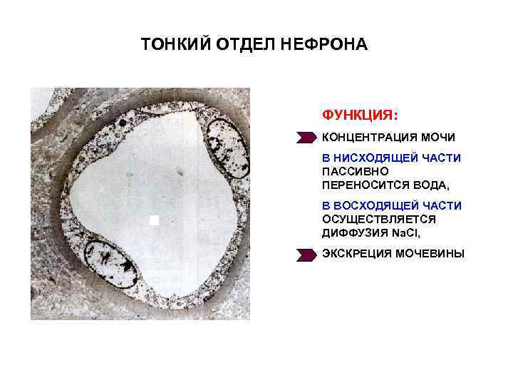 ТОНКИЙ ОТДЕЛ НЕФРОНА ФУНКЦИЯ: КОНЦЕНТРАЦИЯ МОЧИ В НИСХОДЯЩЕЙ ЧАСТИ ПАССИВНО ПЕРЕНОСИТСЯ ВОДА, В ВОСХОДЯЩЕЙ