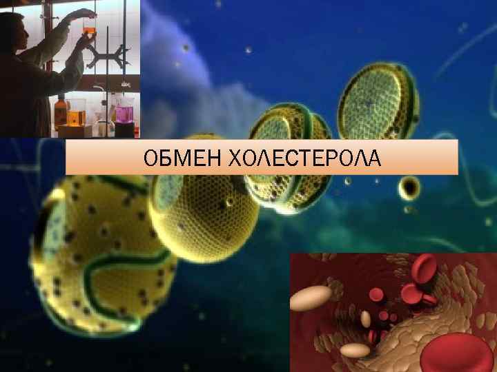 ОБМЕН ХОЛЕСТЕРОЛА 