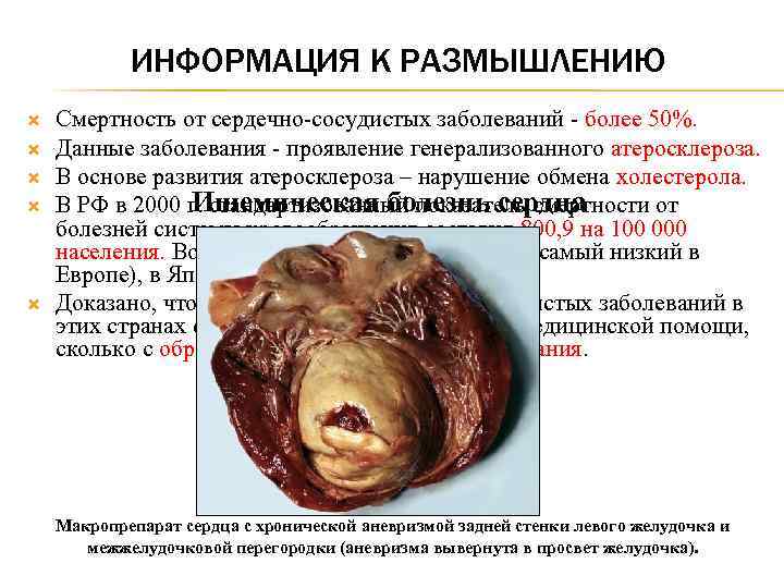 ИНФОРМАЦИЯ К РАЗМЫШЛЕНИЮ Смертность от сердечно-сосудистых заболеваний - более 50%. Данные заболевания - проявление