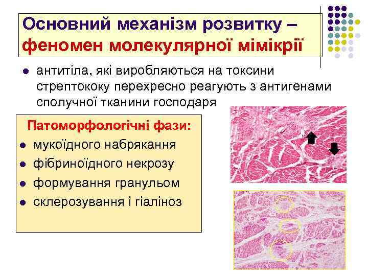 Основний механізм розвитку – феномен молекулярної мімікрії l антитіла, які виробляються на токсини стрептококу