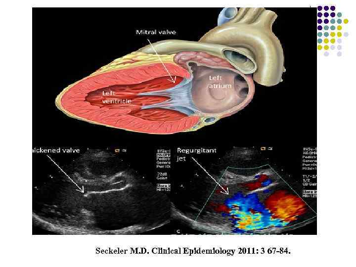 Seckeler M. D. Clinical Epidemiology 2011: 3 67 -84. 