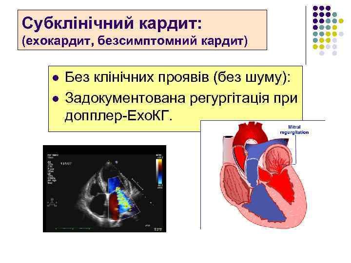 Субклінічний кардит: (ехокардит, безсимптомний кардит) l l Без клінічних проявів (без шуму): Задокументована регургітація
