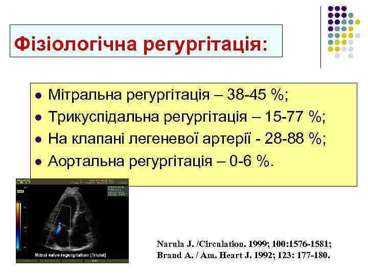 Фізіологічна регургітація: l l Мітральна регургітація – 38 -45 %; Трикуспідальна регургітація – 15