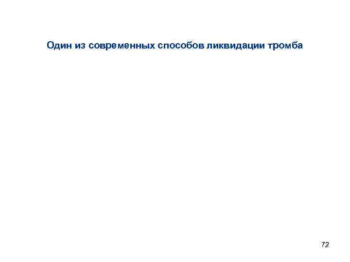 Один из современных способов ликвидации тромба 72 