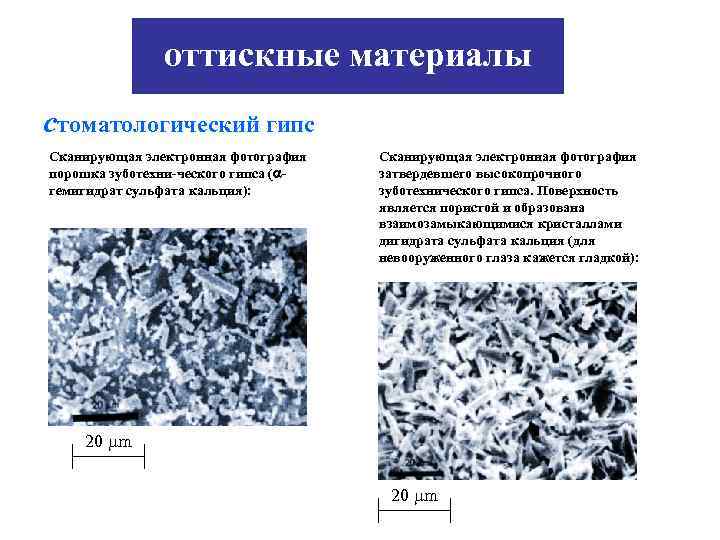 оттискные материалы стоматологический гипс Сканирующая электронная фотография порошка зуботехни-ческого гипса ( гемигидрат сульфата кальция):