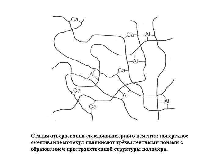 Стадия отвердевания стеклоиономерного цемента: поперечное смешивание молекул поликислот трёхвалентными ионами с образованием пространственной структуры