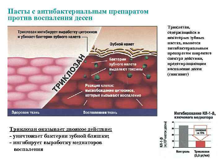 Пасты с антибактериальным препаратом против воспаления десен Триклозан, содержащийся в некоторых зубных пастах, является