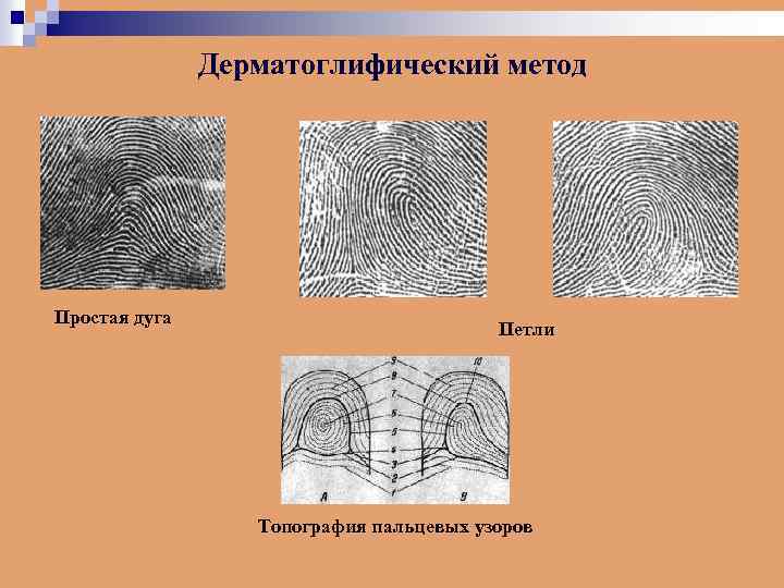 Дерматоглифический рисунок это