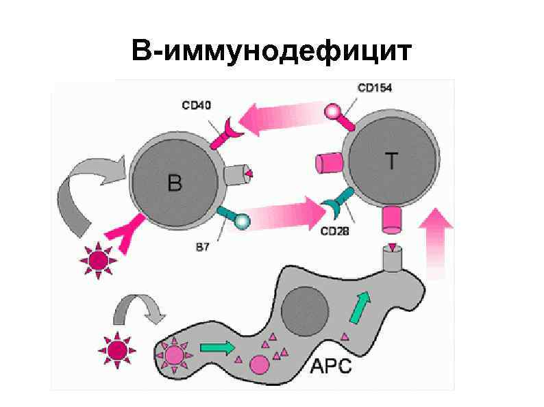 В-иммунодефицит 