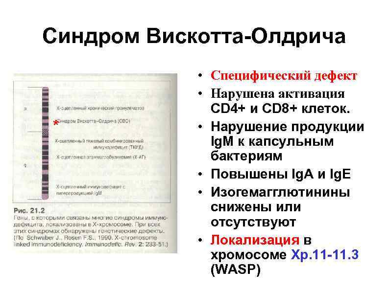 Синдром Вискотта-Олдрича ** * • Специфический дефект • Нарушена активация CD 4+ и CD