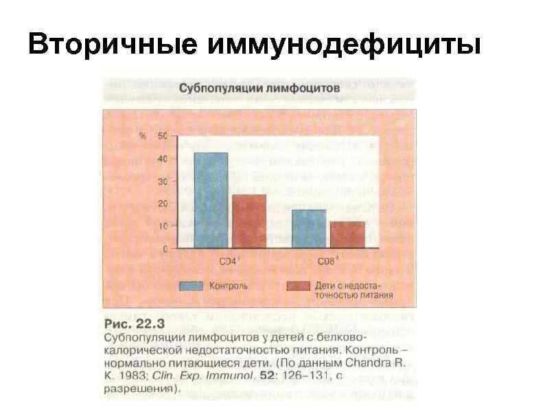 Вторичные иммунодефициты 