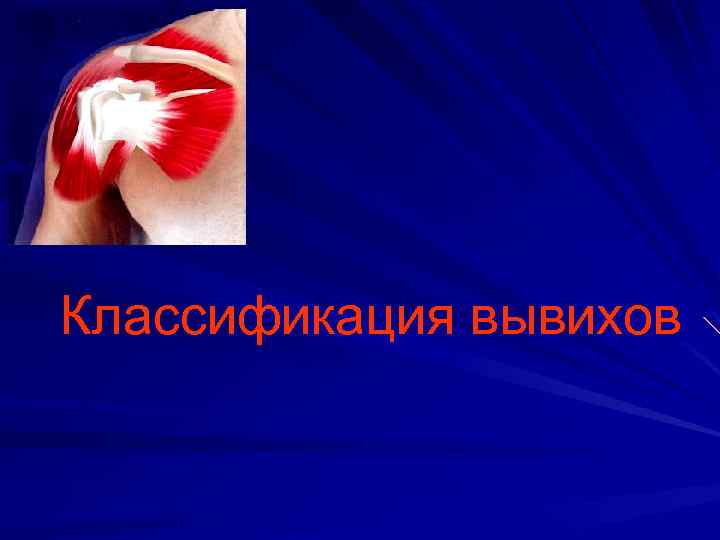 Классификация вывихов 
