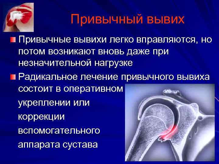 Травма коленного сустава код