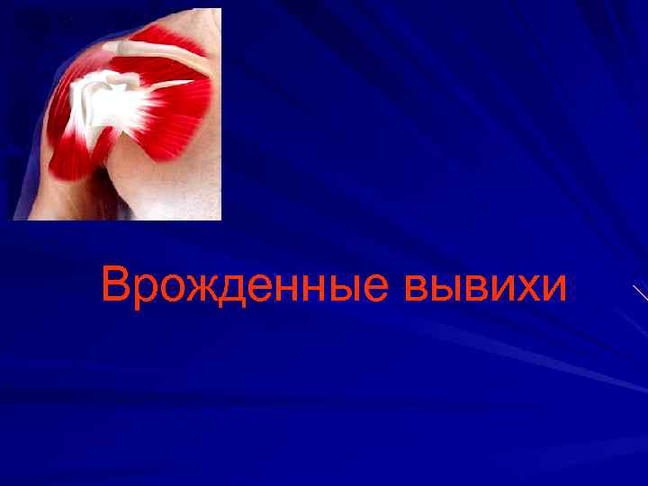 Врожденные вывихи 