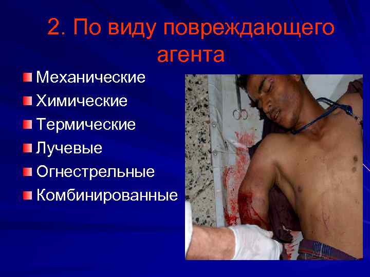 2. По виду повреждающего агента Механические Химические Термические Лучевые Огнестрельные Комбинированные 