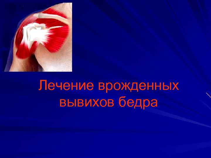 Лечение врожденных вывихов бедра 